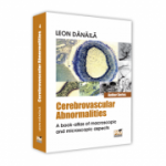Cerebrovascular abnormalities. A book-atlas of macroscopic and microscopic aspects - Leon Danaila