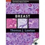 Breast - Thomas J. Lawton MD