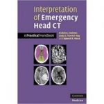 Interpretation of Emergency Head CT: A Practical Handbook - Erskine J. Holmes, Anna C. Forrest-Hay, Dr Rakesh R. Misra