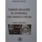 Tumori maligne in domeniul oro-maxilo-facial - Anisoara Hagiu