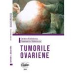 Tumorile ovariene (alb-negru) - Carmen Radulescu