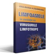 LIMFOAMELE SI VIRUSURILE LIMFOTROPE (Ana Maria Vladareanu)