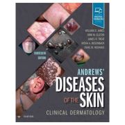Andrews' Diseases of the Skin. Clinical Dermatology - William D. James, Dirk Elston, James R. Treat, Misha A. Rosenbach, Isaac Neuhaus