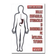 Bolile esofagului, stomacului si duodenului pe intelesul tuturor - Robert Radu Mateescu