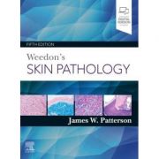 Weedon's Skin Pathology - James W. Patterson