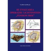 Re-evaluarea operatiei Lichtenstein „tension free” - Florin Gavrilas