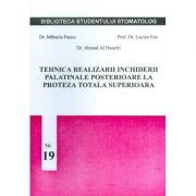 Tehnica realizarii inchiderii palatinale posterioare la proteza totala superioara - Mihaela Pauna