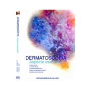 Dermatoscopia, Aspecte Esentiale - Robert H. Johr