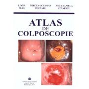 Atlas de colposcopie - Liana Ples, Mircea Octavian Poenaru, Anca Daniela Stanescu