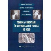 Tehnica cimentarii in artroplastia totala de sold - Marius Niculescu, George Viscopoleanu, Alin Sirbu, Iulian Antoniac