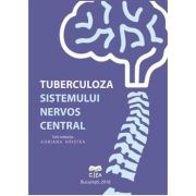 Tuberculoza sistemului nervos central - Adriana Hristea