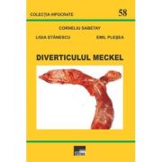 Diverticulul Meckel - Corneliu Sabetay, Ligia Stanescu, Emil Plesea