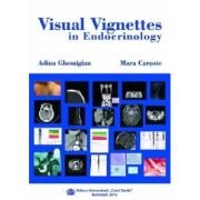 Visual Vignettes in Endocrinology - Adina Ghemigian