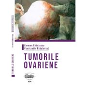 Tumorile ovariene (alb-negru) - Carmen Radulescu