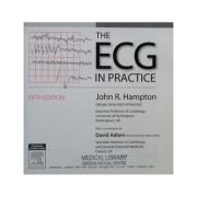 The ECG In Practice
