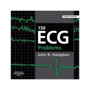 150 ECG PROBLEMS