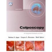Colposcopy: Principles and Practice