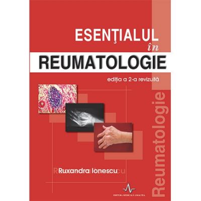 ESENTIALUL IN REUMATOLOGIE EDITIA A 2-A REVIZUITA. (Ruxandra Ionescu)