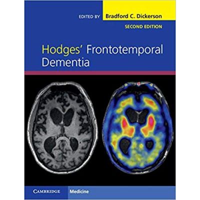 Hodges' Frontotemporal Dementia - Bradford C. Dickerson