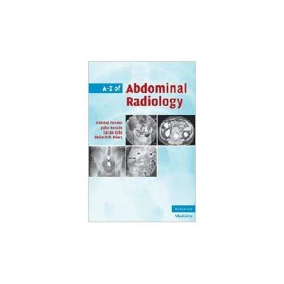 A-Z of Abdominal Radiology - Gabriel Conder, John Rendle, Sarah Kidd, Rakesh R. Misra