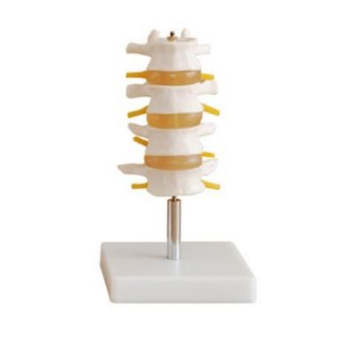 Model sectiune coloana vertebrala cu 4 vertebre