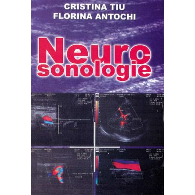 Neurosonologie - Cristina Tiu, Florina Antochi
