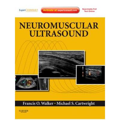 Neuromuscular Ultrasound - Francis Walker, Michael S. Cartwright