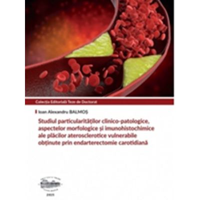 Studiul particularitatilor clinico-patologice - Ioan Alexandru Balmos