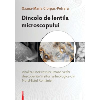 Dincolo de lentila microscopului. Analiza unor resturi umane vechi descoperite in situri arheologice din Nord‑Estul Romaniei - Ozana‑Maria Ciorpac‑Petraru