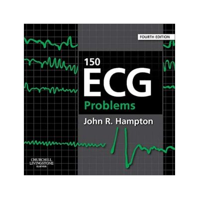 150 ECG PROBLEMS