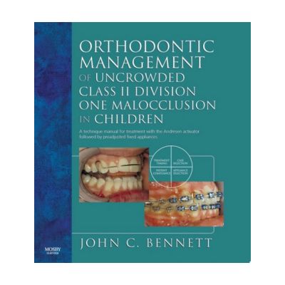 Orthodontic Management of Uncrowded Class II Division One Malocclusion in Children
